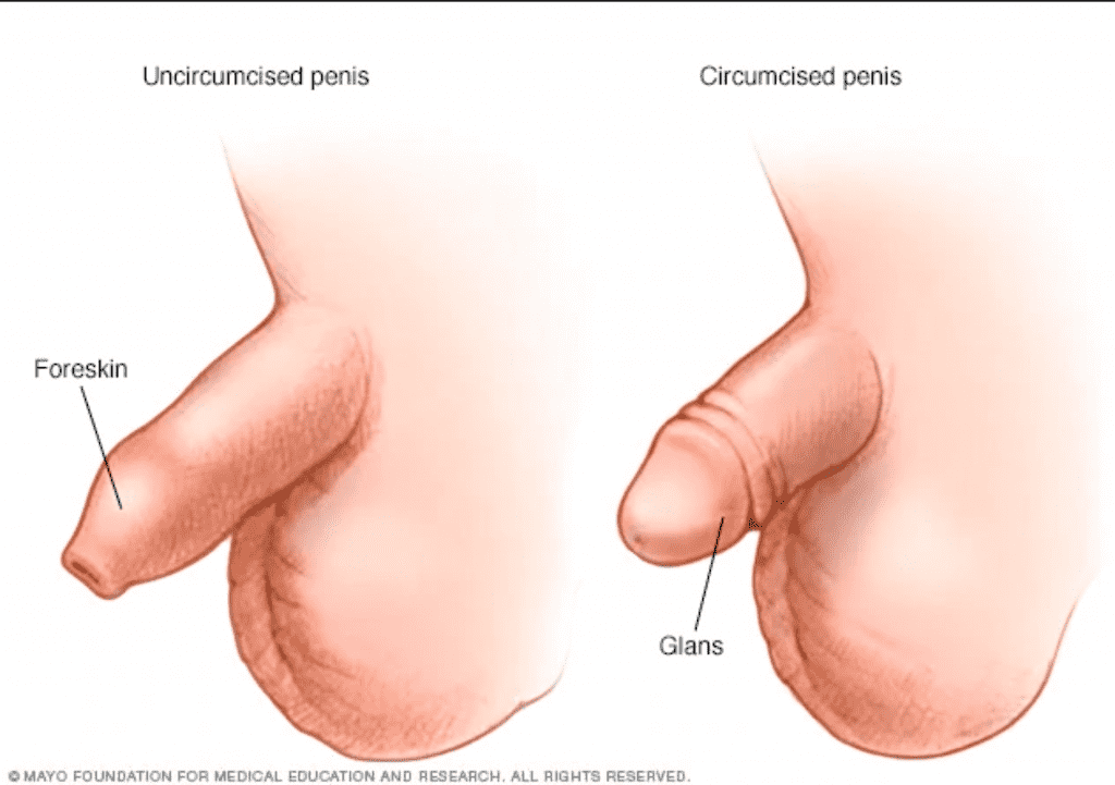 circumcised vs uncircumcised penis